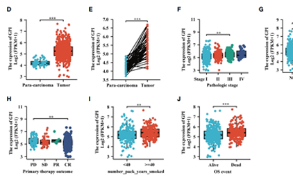 GPI Is a Prognostic Biomarker and Correlates With Immune Infiltrates in Lung Adenocarcinoma